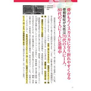 猪瀬弘之 80歳の壁を超える 骨がみるみる強ま...の詳細画像2