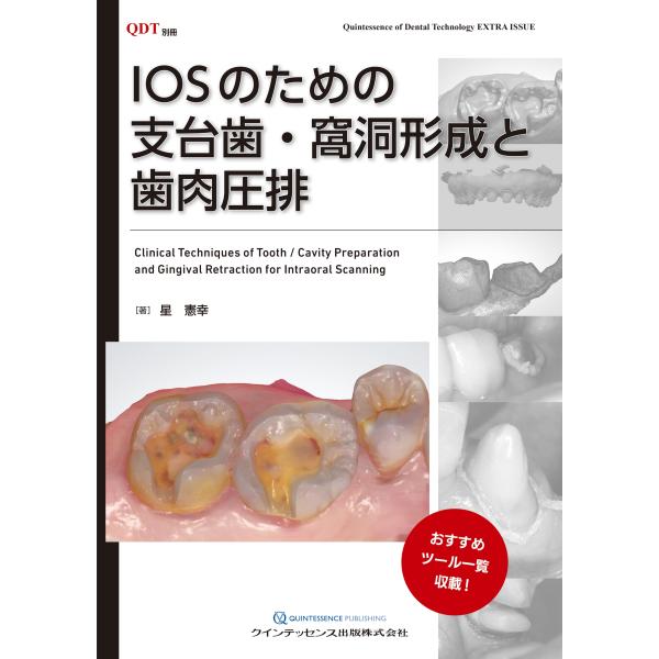星憲幸 IOSのための支台歯・窩洞形成と歯肉圧排 Book