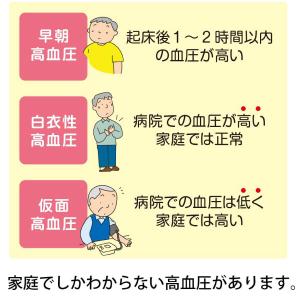 オムロン 血圧計 上腕式 フィットカフ メモリ...の詳細画像2