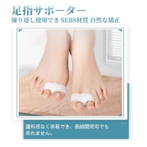 外反母趾 足指サポーター 5タイプ 矯正器 分...の詳細画像1