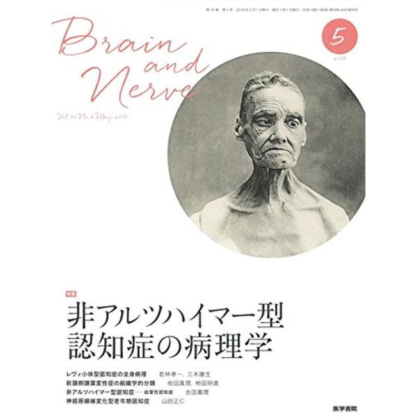 BRAIN AND NERVE 神経研究の進歩 2018年 5月号 特集 非アルツハイマー型認知症の...