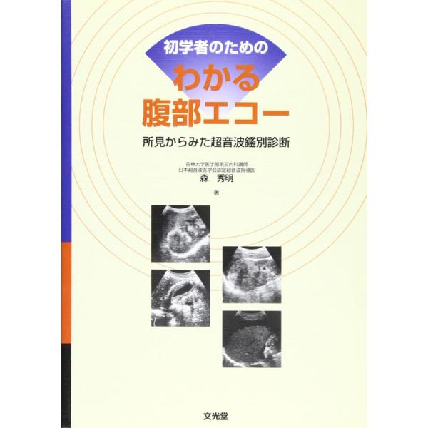 初学者のためのわかる腹部エコー?所見からみた超音波鑑別診断