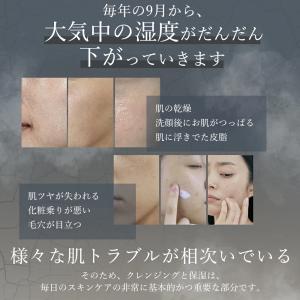 スチーマー美顔器 anlan 毛穴ケア 顔 髪...の詳細画像2