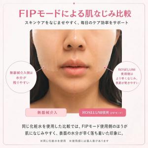 アンバサダー山本美月 anlan 美顔器 Ro...の詳細画像4