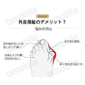 外反母趾サポーター シリコンゴム 足指 つま先...の詳細画像4