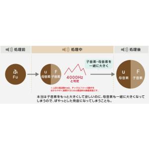 アクトス補聴器PR2(MNR) 外耳道レシーバ...の詳細画像4