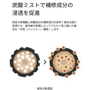 BF 炭酸ミストスターターセット ゾイック ビ...の詳細画像1