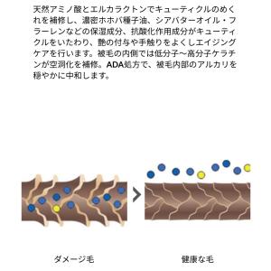 BF 炭酸ミストスターターセット ゾイック ビ...の詳細画像2