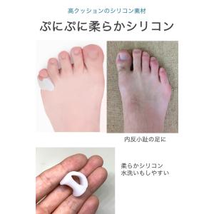 内反小趾サポーター Bタイプ 2組(4個)セッ...の詳細画像2