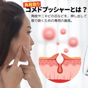 コメドプッシャー 毛穴ケア 毛穴 毛穴ケア専用...の詳細画像1
