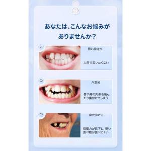 着脱可能な美白付け歯、義歯 入れ歯 上下 シリ...の詳細画像2