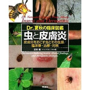 虫と皮膚炎 Ｄｒ．夏秋の臨床図鑑  /学研メディカル秀潤社/夏秋優 (大型本) 中古