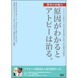 【中古】 原因がわかるとアトピーは治る。 [レンタル落ち] [DVD]