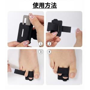 【並行輸入品】足指サポーター アルミ板付き 関...の詳細画像2