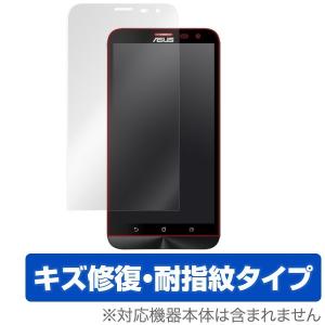 OverLay Magic for ASUS ZenFone 2 Laser (ZE601KL) 液...