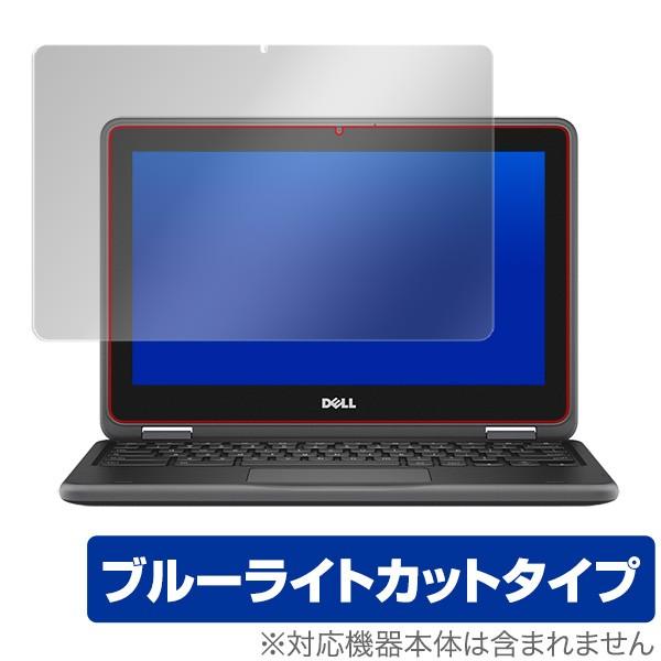 デル クロームブック11 3100 2in1 用 保護 フィルム OverLay Eye Prote...