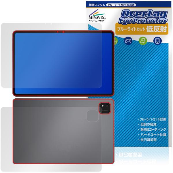 ALLDOCUBE iPlay 70 Pad Pro 表面 背面 保護フィルム OverLay Ey...