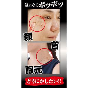 イボ イボ取り 除去 首 ポロポロ ジェル 顔...の詳細画像2