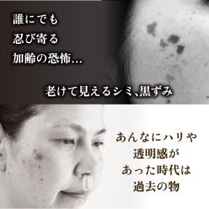 シミ取りパッチ シミ パッチ パック シミ取り...の詳細画像1