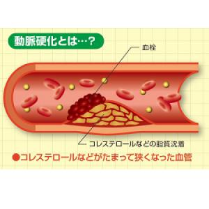 ヘルスオイル 360カプセルx2個 120日分...の詳細画像4