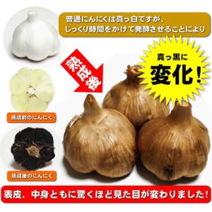 黒にんにく 青森 1キロ 国産 無添加 熟成 ...の詳細画像5