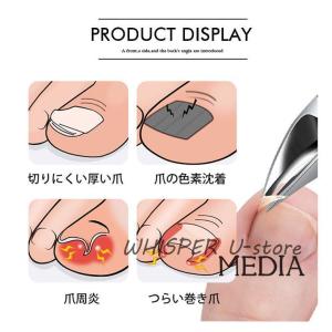 巻き爪用爪切り 爪切り ニッパーつめきり 足用...の詳細画像4
