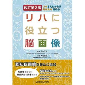 コツさえわかればあなたも読める リハに役立つ脳画像?改訂第2版｜white-wings2