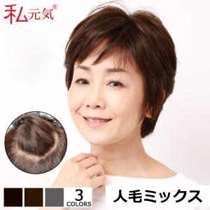 フォンテーヌ アデランス 医療用フルウィッグ 女性用全頭かつら 分け目