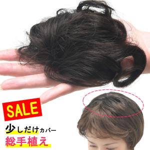 ヘアピース 円形脱毛症 部分ウィッグ ポイントウィッグ 増毛 人気 つむじカバー ストレート 薄毛隠し 抗がん剤治療 総手植え　tk7souteue