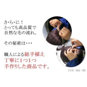 ウィッグ ヘアピース 人毛 円形脱毛症 部分ウ...の詳細画像3