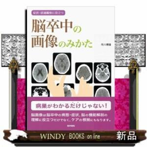 脳卒中の画像のみかた  症状・経過観察に役立つ