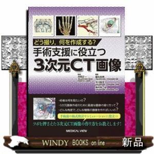 どう撮り，何を作成する？手術支援に役立つ３次元ＣＴ画像