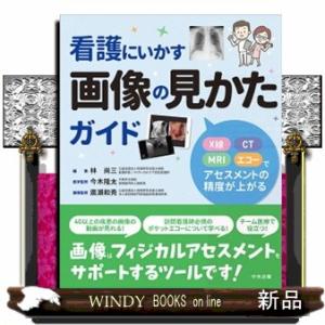 看護にいかす画像の見かたガイド  Ｘ線・ＣＴ・ＭＲＩ・エコーでアセスメントの精度が上がる
