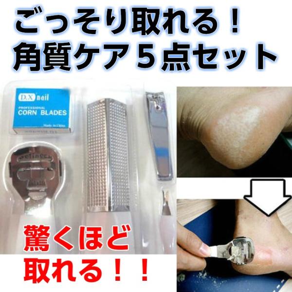 かかと 角質取り 5点セット 角質除去 踵 ケア つるつる 魚の目 角質削り 替刃