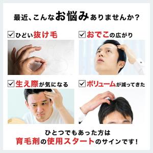 育毛剤 男性用 育毛 発毛促進 抜け毛予防 ス...の詳細画像3