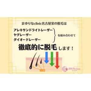 ふるさと納税 名古屋市 【男性医療脱毛】VIO...の詳細画像3