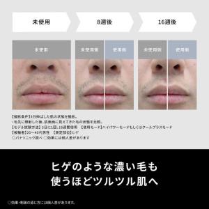 パナソニック Panasonic 家庭用脱毛器...の詳細画像2
