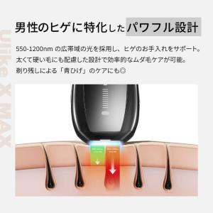 ULIKE Ulike X Max IPL光美...の詳細画像3