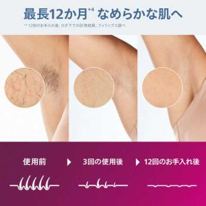 フィリップス PHILIPS 家庭用脱毛器 ル...の詳細画像4
