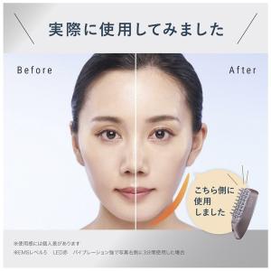 ANGFA スカルプ電気ブラシ スカルプD ボ...の詳細画像3