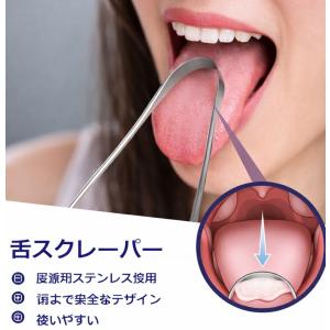 ORAVIX 膿栓除去キット 家庭用 口腔セル...の詳細画像5