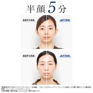 ヤーマン ブラシ 美顔器 ハイパーフェイスリフ...の詳細画像1