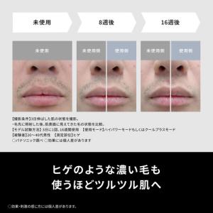 パナソニック ES-WG0B-H スムースエピ...の詳細画像2