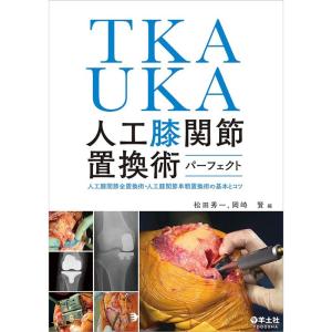 TKA・UKA 人工膝関節置換術パーフェクト〜人工膝関節全置換術・人工膝関節単顆置換術の基本とコツ｜yanbaru