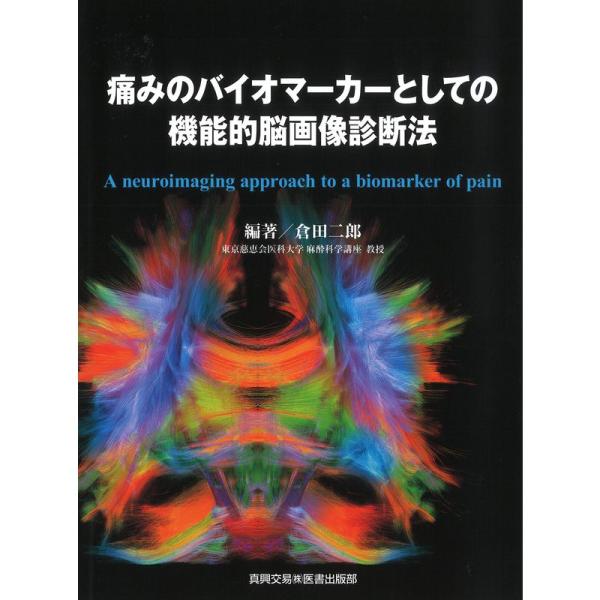 痛みのバイオマーカーとしての 機能的脳画像診断法