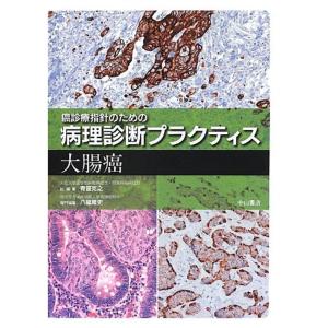 大腸癌 (癌診療指針のための病理診断プラクティス)｜yanbaru