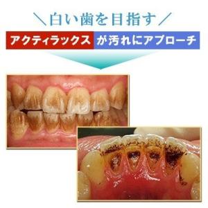 ホームホワイトニング ホワイトニング 自宅 l...の詳細画像3