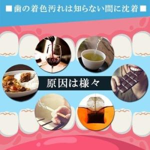 ホームホワイトニング ホワイトニング 自宅 l...の詳細画像4