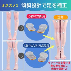 O脚矯正インソール 中敷き O脚補正 インソー...の詳細画像2