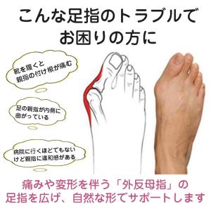 2セット目半額!外反母趾 サポーター 足 指 ...の詳細画像1